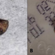 El caracol encontrado. BMJ Case Reports